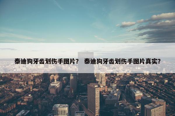 泰迪狗牙齿划伤手图片？ 泰迪狗牙齿划伤手图片真实？